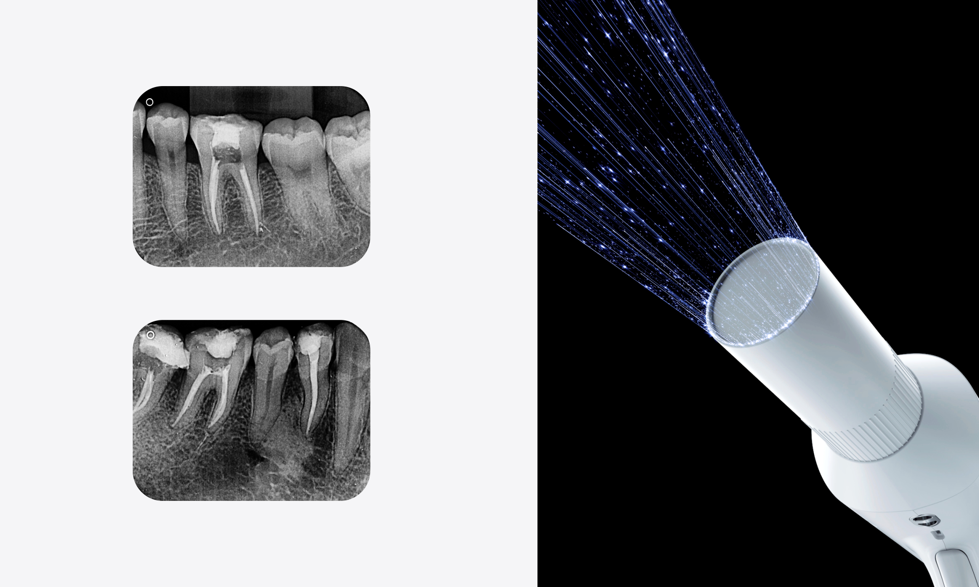 0.4mm Focus Tube Clear Imaging